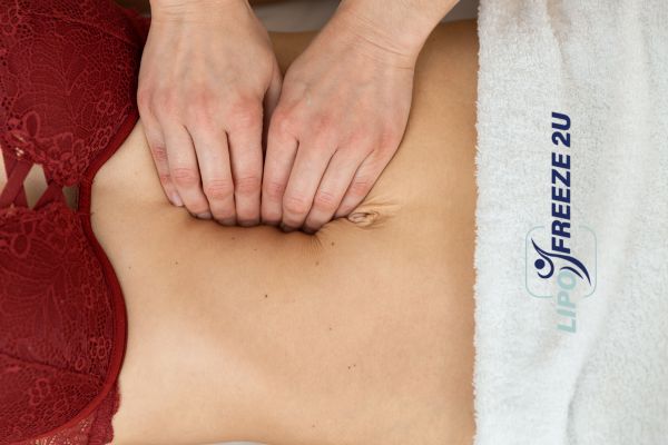diastasis recti treatment Leicestershire