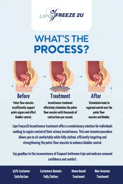 Diagram of how incontinence treatment Leicestershire works.