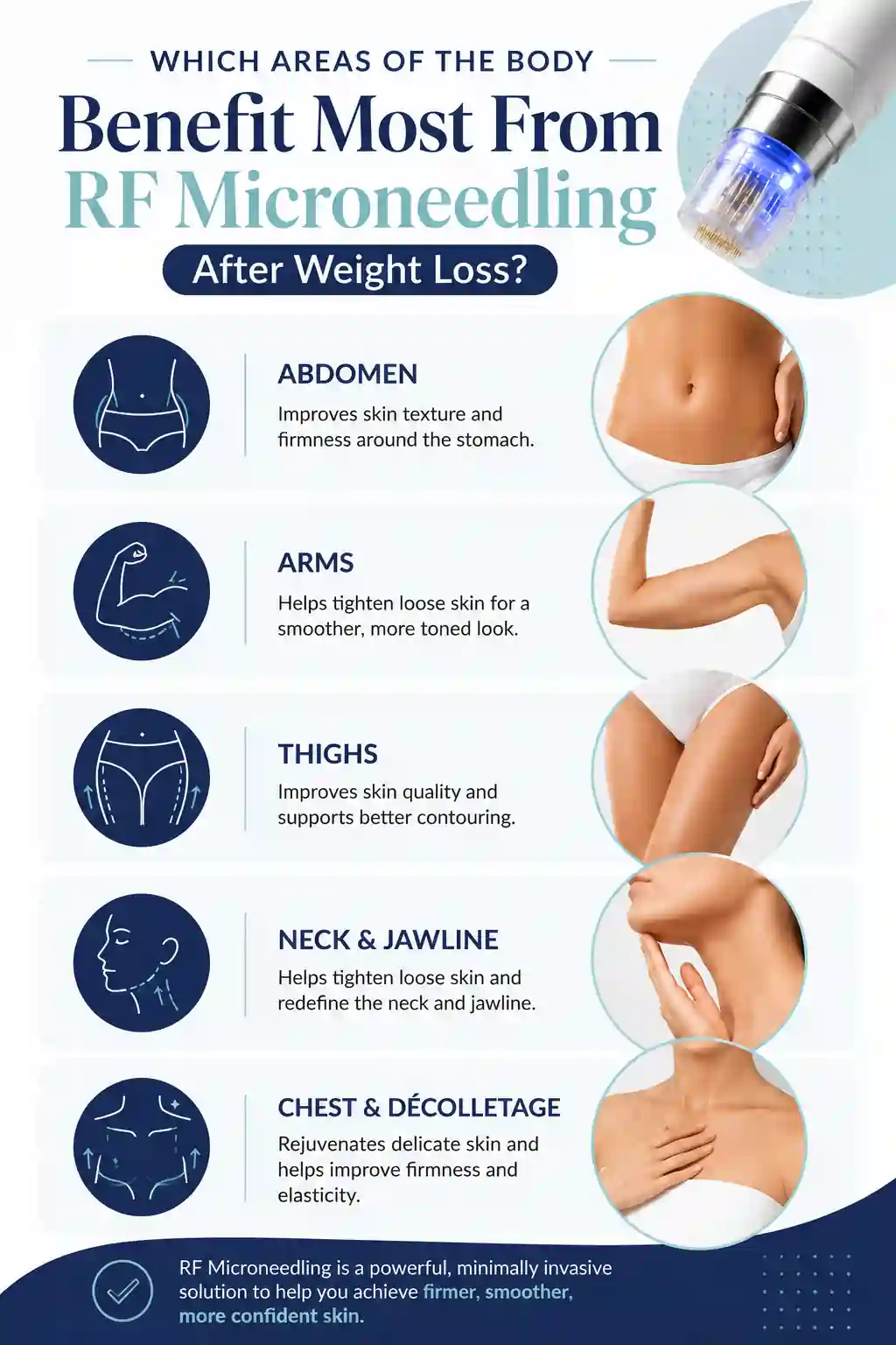 Which Areas of the Body Benefit Most From RF Microneedling After Weight Loss Leicestershire